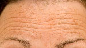 Tratamiento ocular