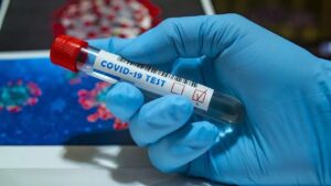 Muestra de test de detección de COVID-19 sostenida por un profesional sanitario con guantes.